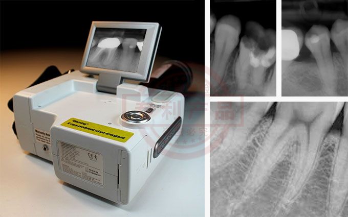 iRay D4牙医专用小型X光机